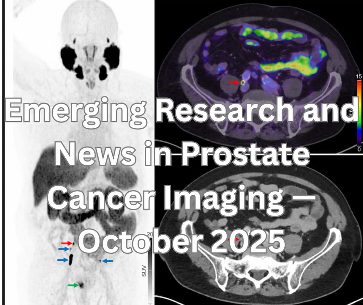 Emerging Research and News in Prostate Cancer Imaging — October 2025
