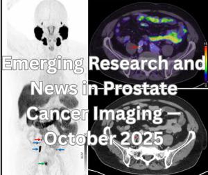 Emerging Research and News in Prostate Cancer Imaging — October 2025 