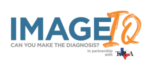 Image IQ Quiz: Middle-Aged Man Presents with Left-Sided Weakness