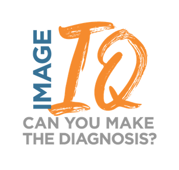 Image IQ Quiz: 47-Year-Old Man with Large Neck Mass and Left Ear Pain 