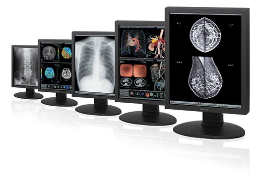 6 Innovative High-Performance Displays for Radiology