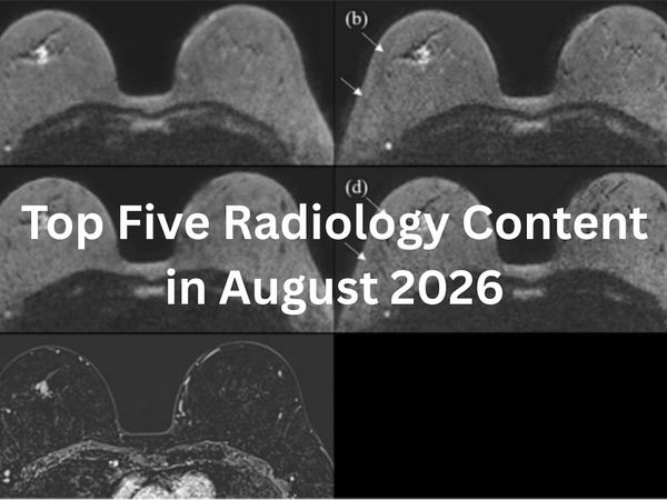 Top Five Radiology Content in August 2026