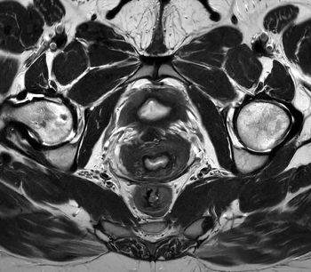 Philips Launches AI-Powered SmartSpeed Precise MRI Software at ECR