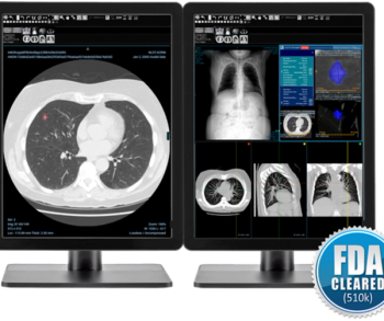 FDA Clears AI-Powered Software for Lung Nodule Detection on Chest CT