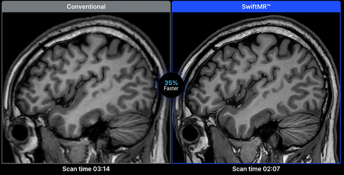 AIRS Medical Launches Update of AI-Powered MRI Software SwiftMR
