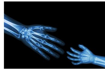 Pediatric imaging