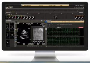 Philips to Showcase Newly FDA-Cleared Cardiovascular Workspace at RSNA