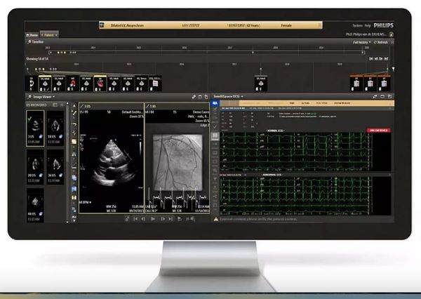 Philips to Showcase Newly FDA-Cleared Cardiovascular Workspace at RSNA