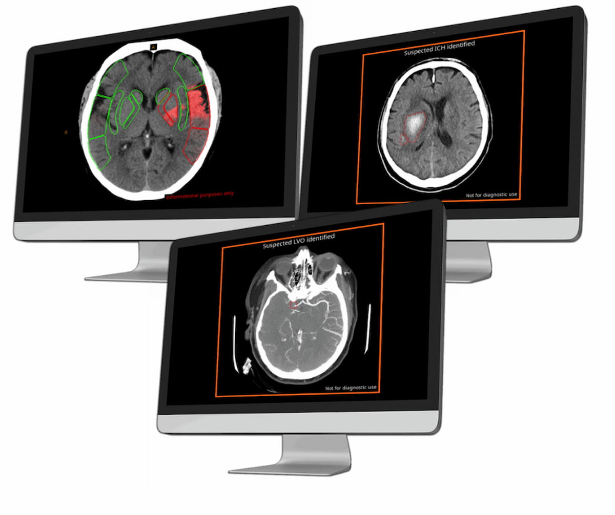Emerging Radiology Platform Offers Access to Variety of CT-Based AI Applications 
