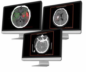 Emerging Radiology Platform Offers Access to Variety of CT-Based AI Applications 