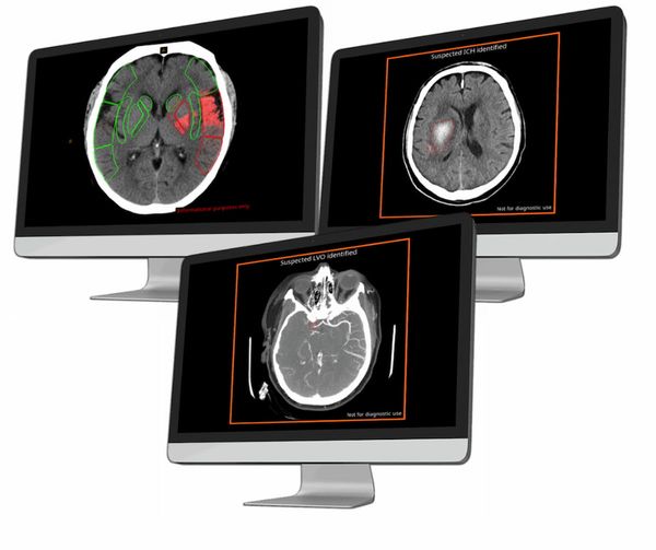 Emerging Radiology Platform Offers Access to Variety of CT-Based AI Applications 