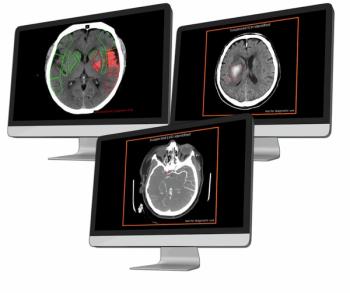 Emerging Radiology Platform Offers Access to Variety of CT-Based AI Applications