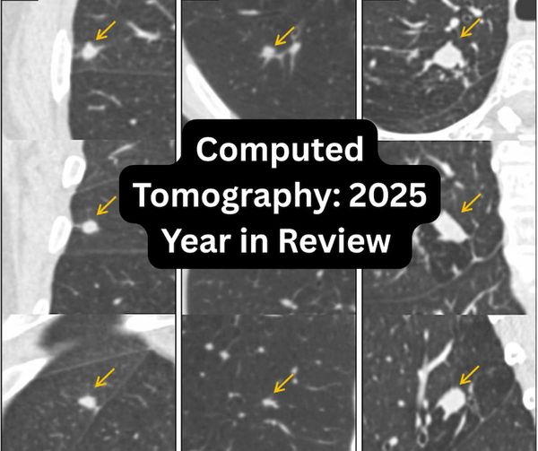 Computed Tomography: 2025 Year in Review