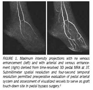 High-field cardiac MR imaging enjoys continued strong progress