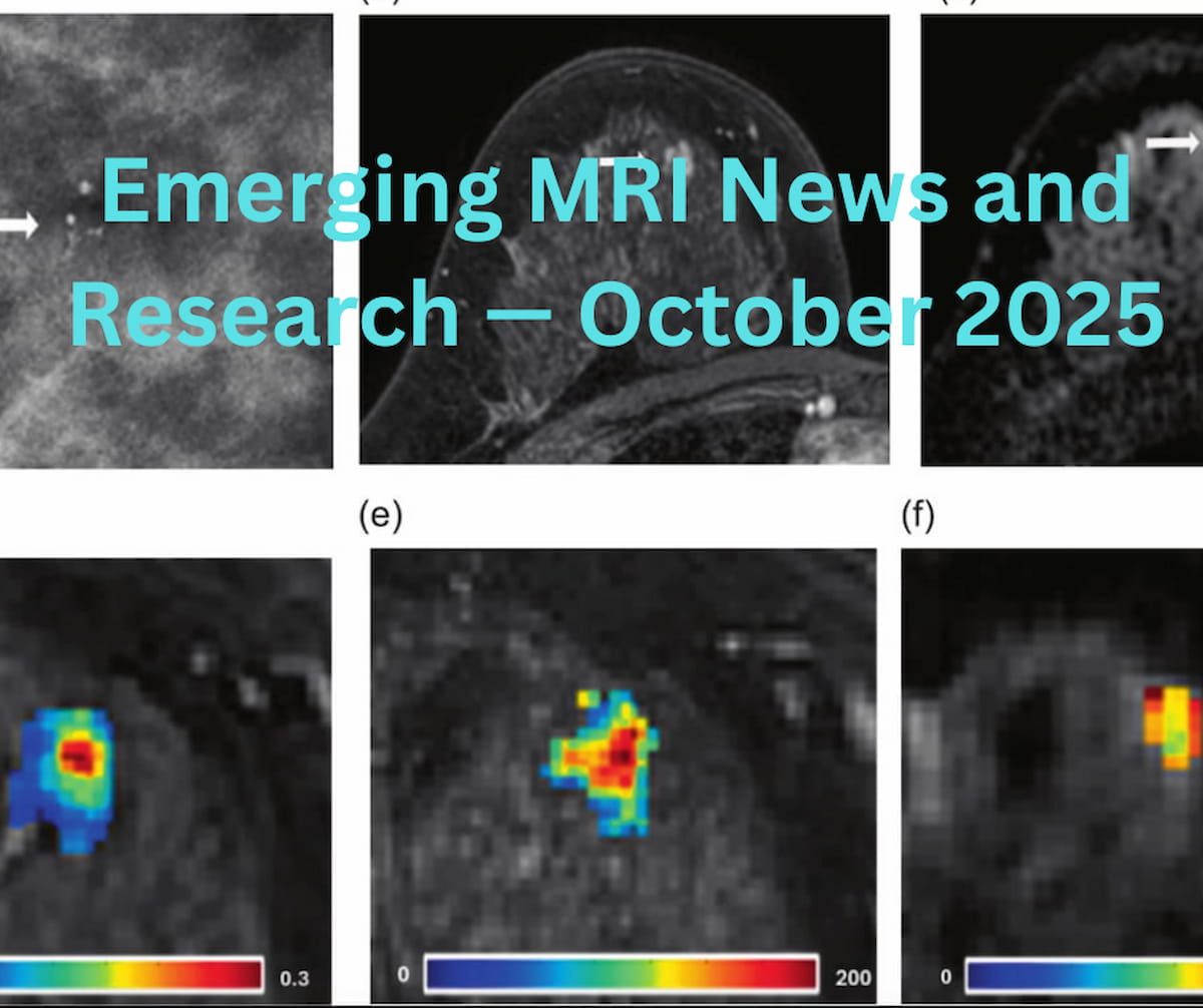 Emerging MRI News and Research — October 2025