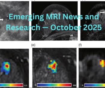 Emerging MRI News and Research — October 2025