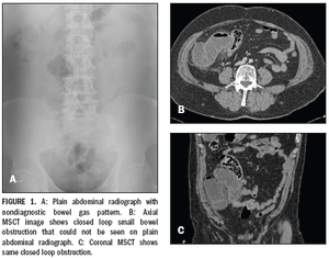 Patient-specific approach assists in acute abdomen