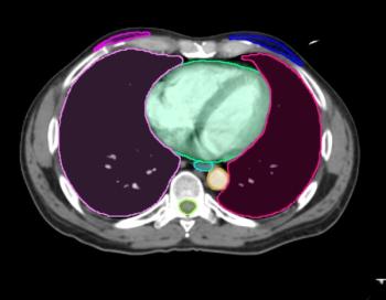 FDA Clears Update of AI-Enabled Imaging Contour Models