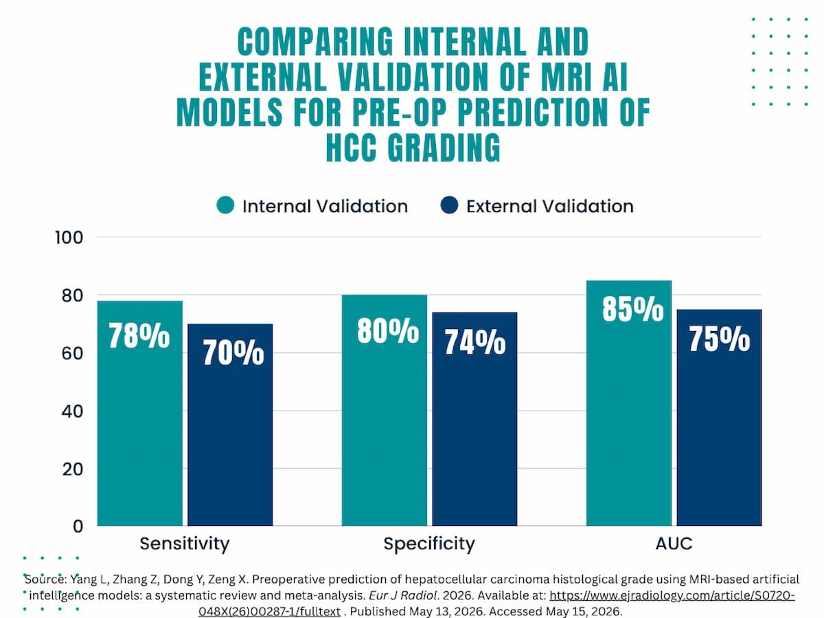 MRI-Based AI Models Show Significant Decline in External Validation for Pre-Op Prediction Grading of HCC