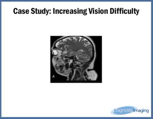 Increasing Vision Difficulty