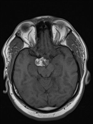 Image IQ: 46-year-old Male with Headache