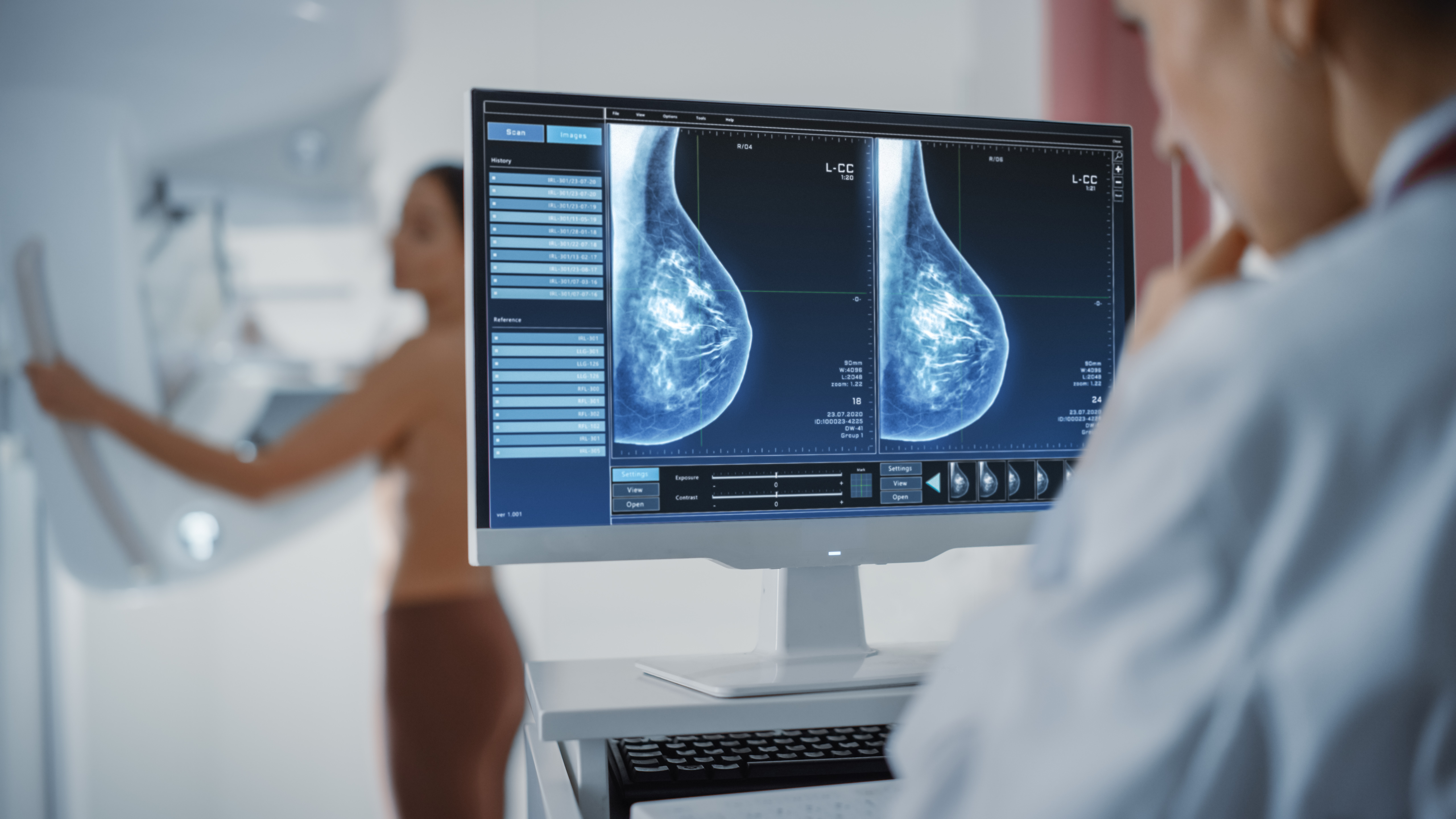 New Mammography Study Examines Association Between Breast Density Changes and Breast Cancer Risk