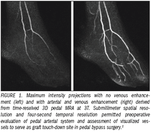 High-field cardiovascular MRI makes sustained progress
