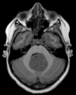 Image IQ Quiz: Pediatric Patient Presents with Double Vision