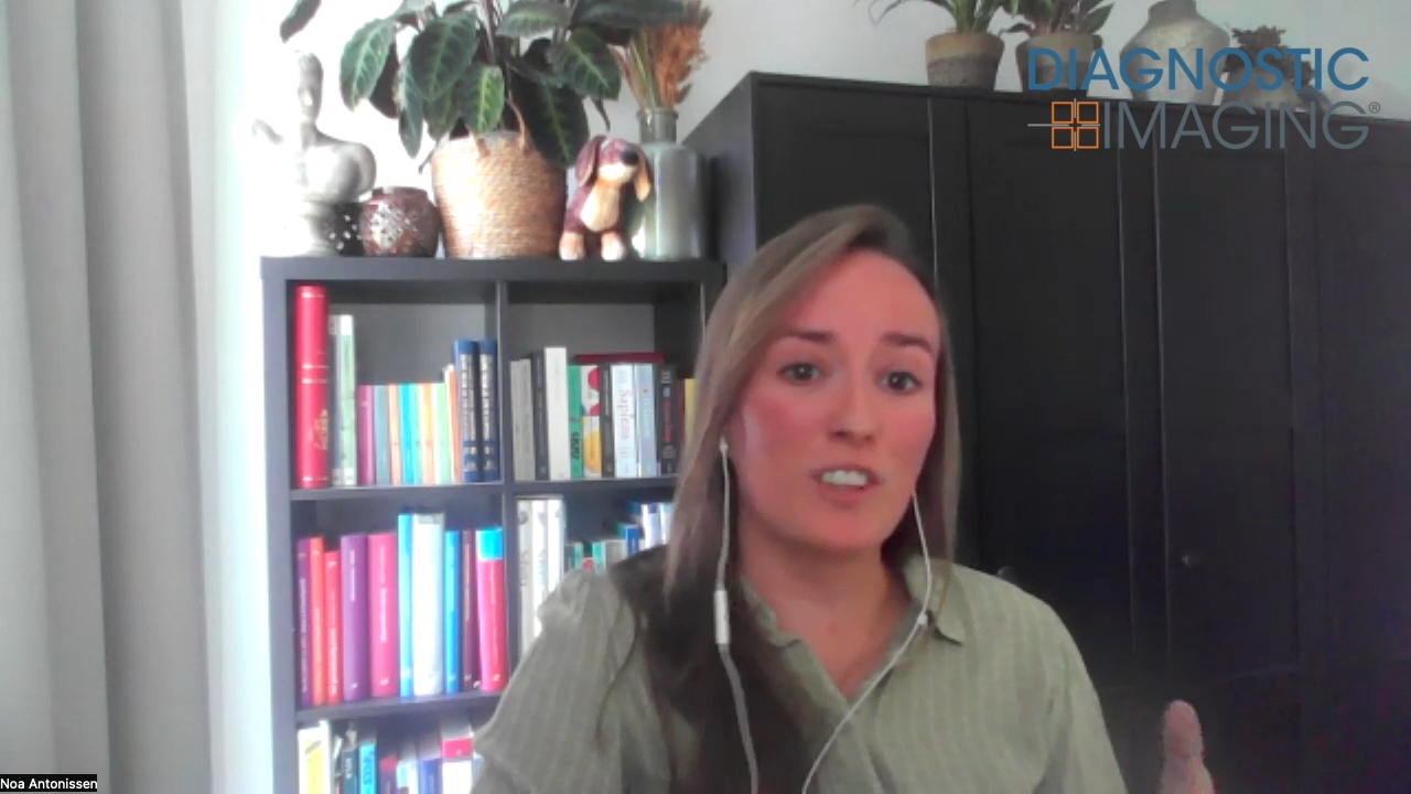 CT-Based Deep Learning Model May Reduce False Positives with Indeterminate Lung Nodules by Nearly 40 Percent