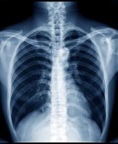 Aidoc’s First Read X-Ray Reporting Software Gets FDA’s Breakthrough Device Designation