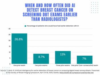 Can AI Detect Breast Cancer on DBT Years Earlier than Radiologists?