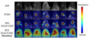 Explainable AI Model for Breast MRI Shows Effectiveness in High and Low Prevalence Breast Cancer Datasets