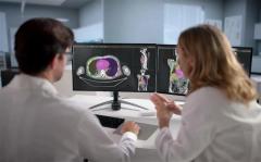 FDA Clears AI Software for Automated Contouring in Radiation Oncology