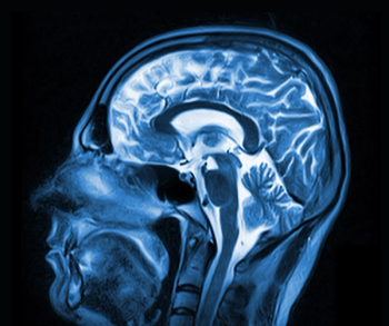New MRI Research Explores Links Between Waist-to-Hip Ratio and Memory in Aging