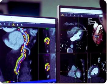 FDA Grants De Novo Authorization for AI-Based Coronary Inflammation Quantification from CCTA Exams