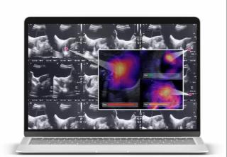 FDA Issues De Novo Clearance of Ultrasound AI Software for Delivery Date Prediction