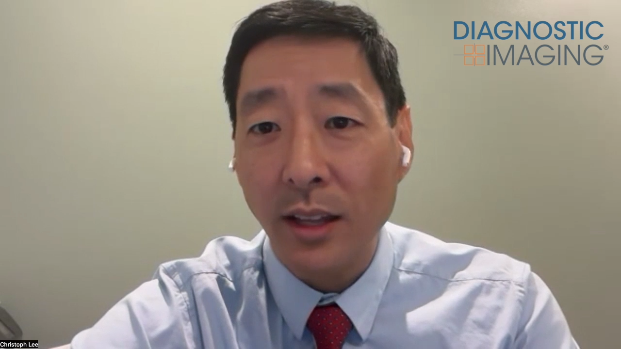 Mammography Study: Multi-Stage Use of AI for DBT Exams Yields Over 21 Percent Increase in Breast Cancer Detection