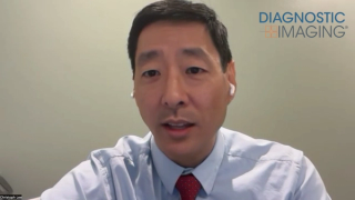 Mammography Study: Multi-Stage Use of AI for DBT Exams Yields Over 21 Percent Increase in Breast Cancer Detection