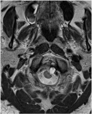 Image IQ: 69 year old man with headaches.