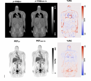 SNMMI: Can Ultra-Low Dose PET Supplant the Need for CT Attenuation Correction?