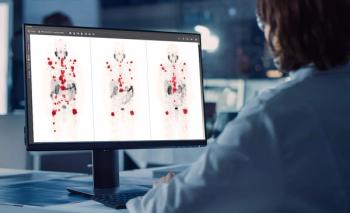 GE HealthCare Unveils Enhanced LesionID Pro at SNMMI Conference