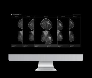 FDA Clears Updated Version of 3D Mammography Algorithm from Lunit