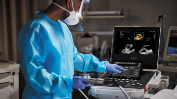 New AI-Enabled Portable Ultrasound May Facilitate 50 Percent Reduction in Cardiac Imaging Scan Time