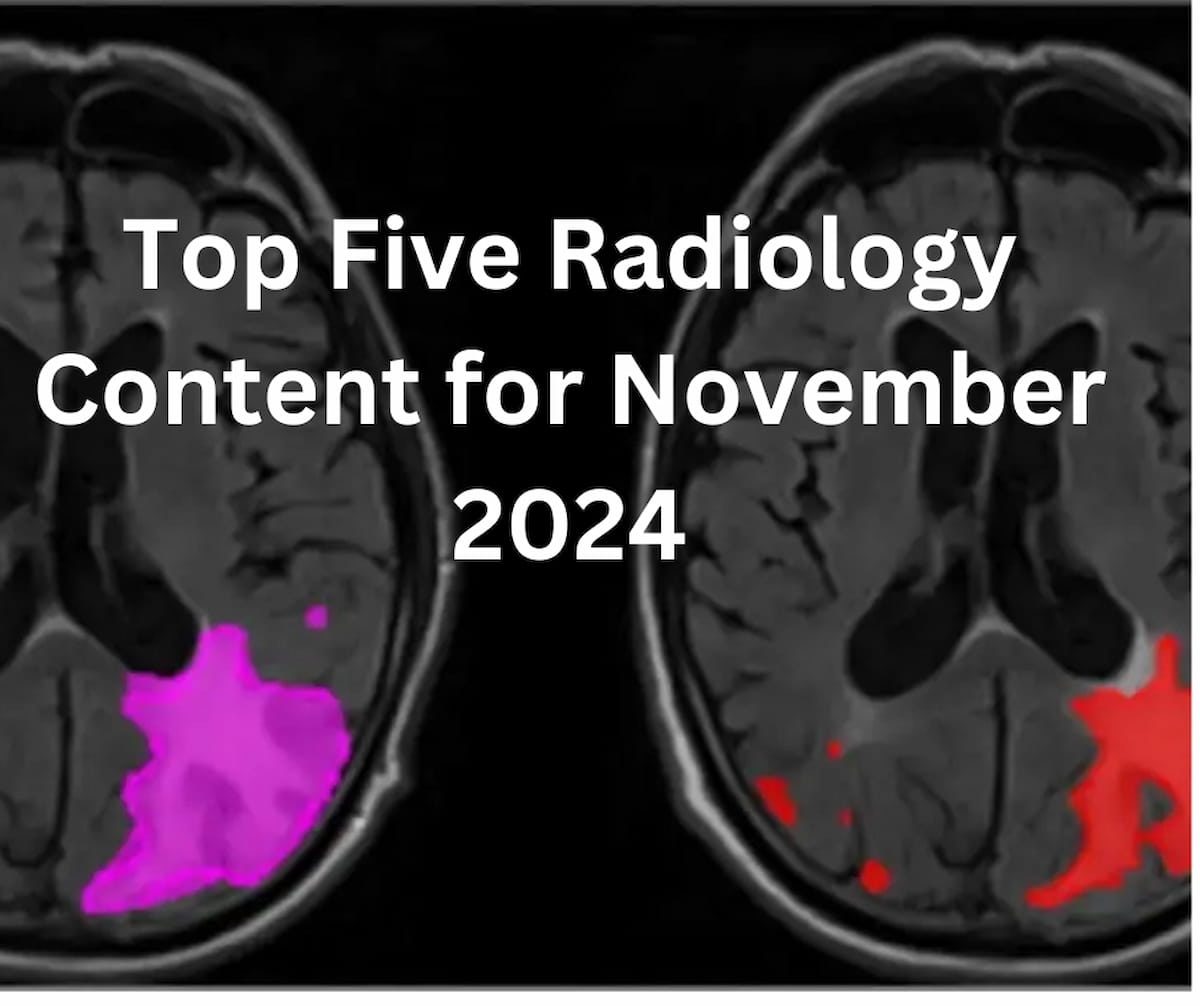 Top Five Radiology Content for November 2024
