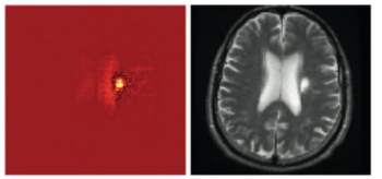 New Survey Explores Radiologist and Neurologist Comfort Level with AI Triage for Brain MRI
