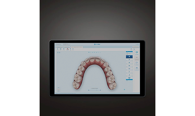 ClinCheck 6.0