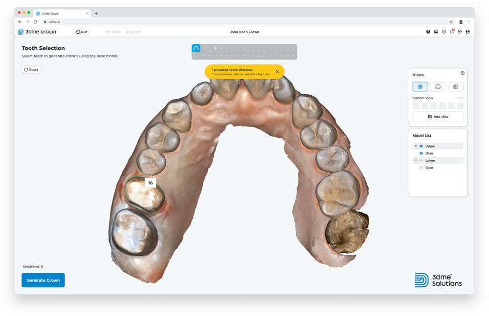 New AI-Based Web Dental CAD Designed To Offer One-Click Crown Design