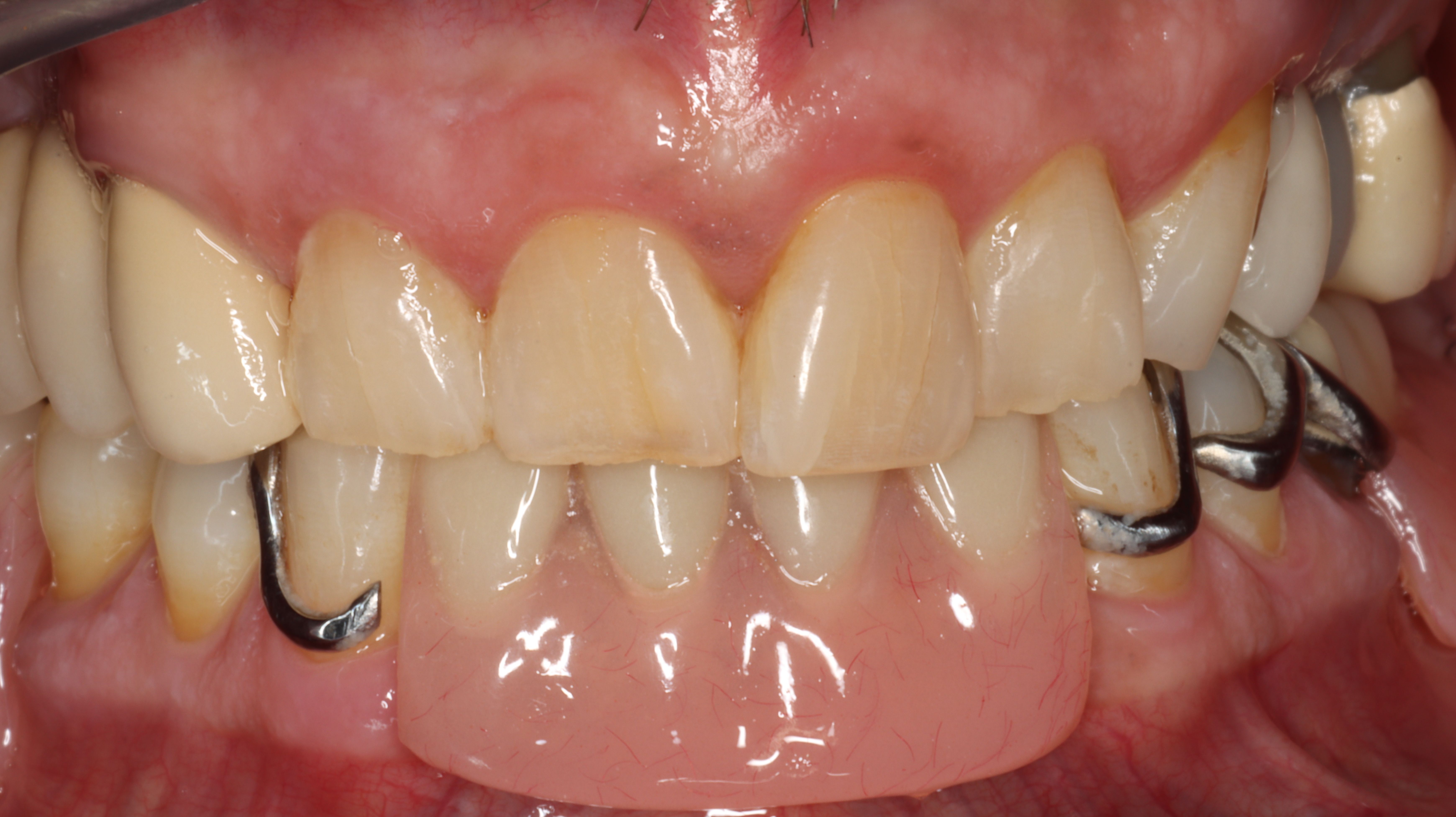 Case Report: EndoPilot Technology Expedites Multidisciplinary Dental ...