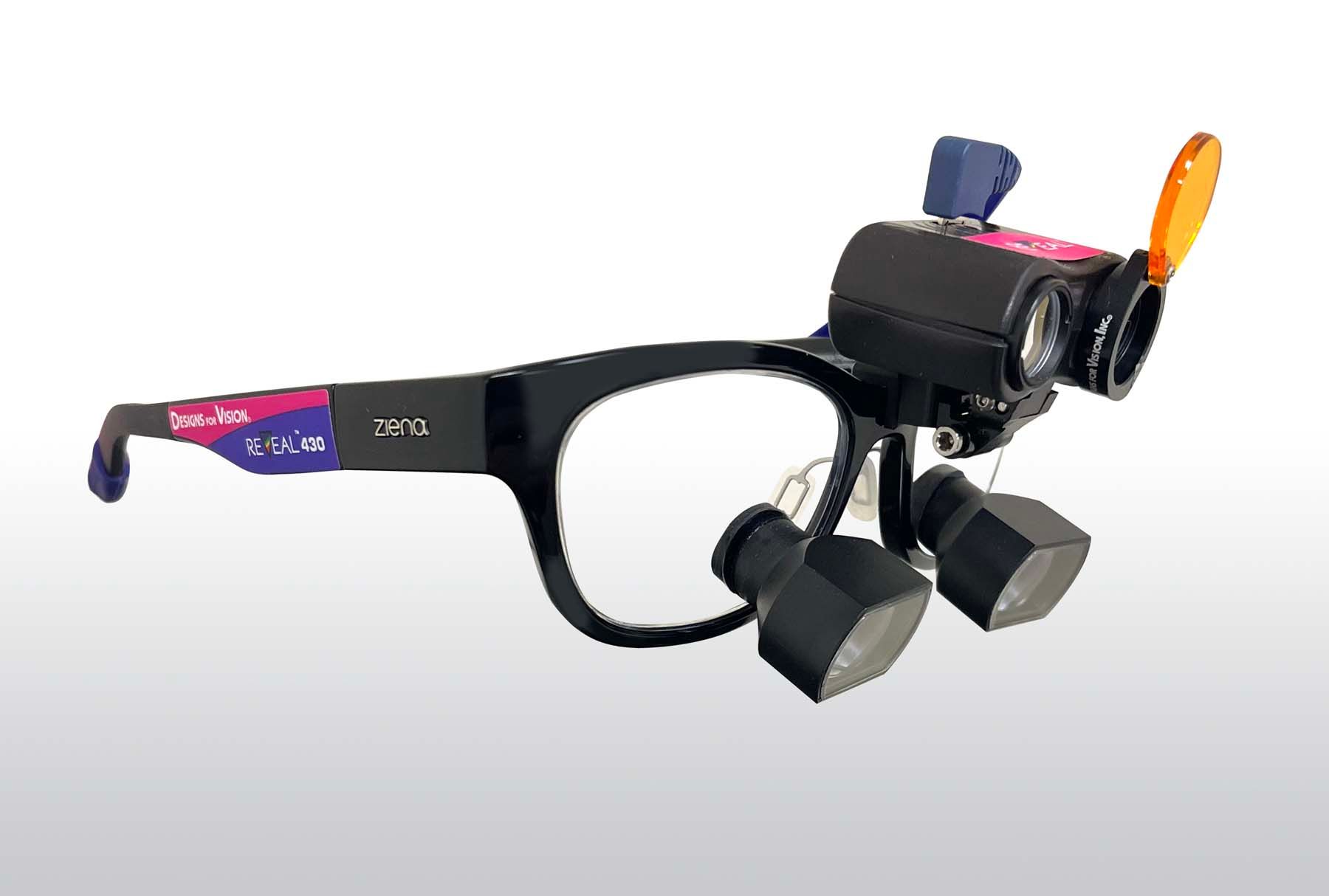 健康・医学 Aligner generation 健康・医学 Aligner generation Full article: Clear aligners