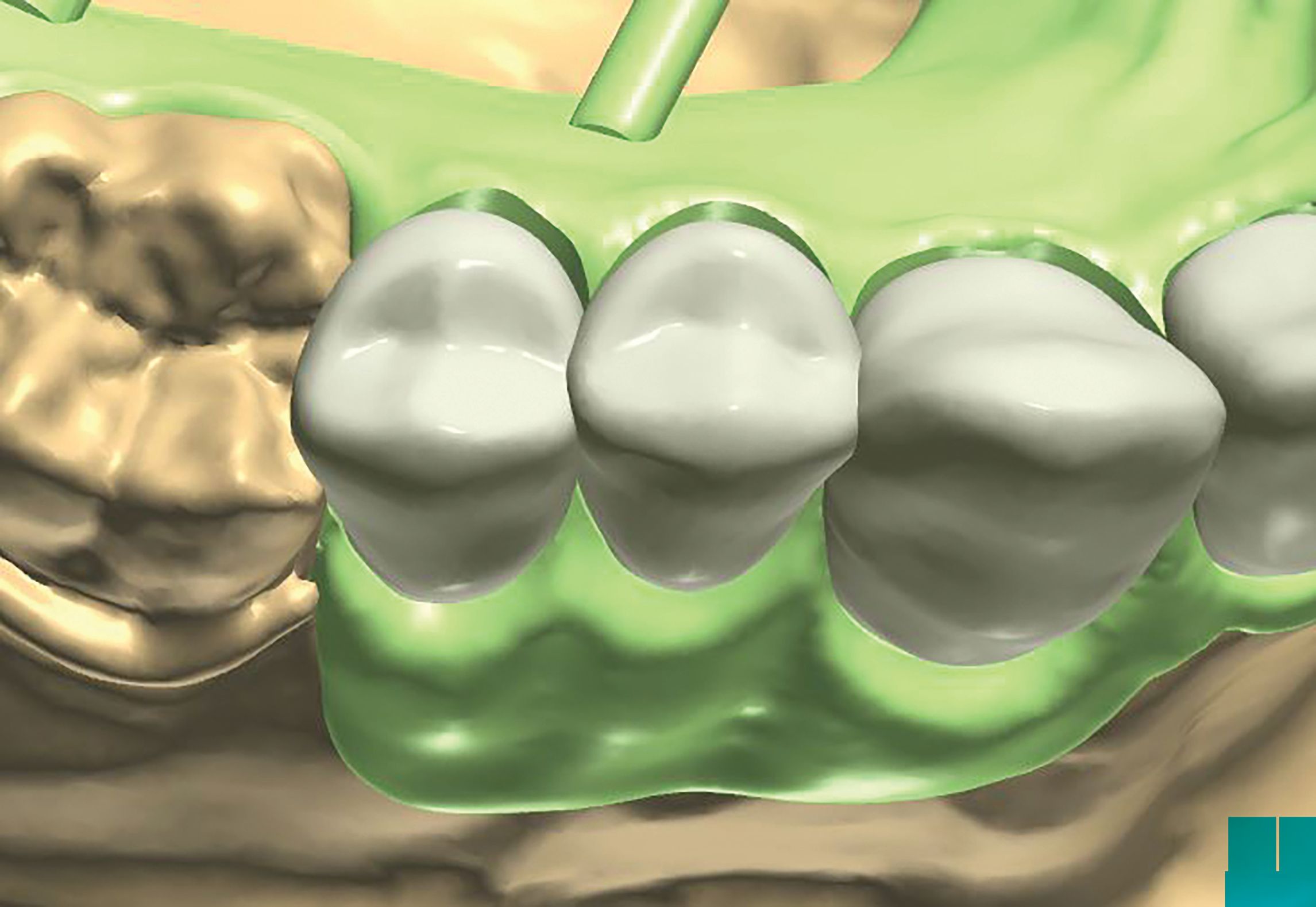 How to balance digital and analog design